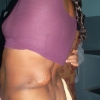 Cisti
